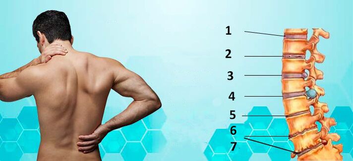 Az osteochondrosis fejlődési szakaszai